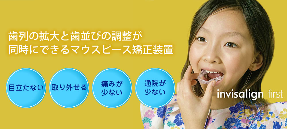 目立たない子供のマウスピース矯正インビザライン・ファースト